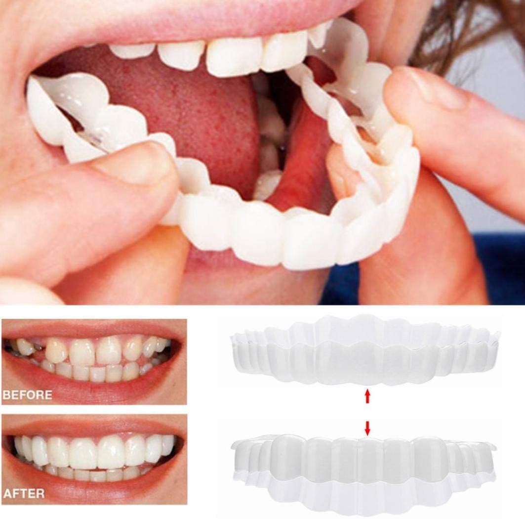 Instant Smile Perfect Veneers Kit