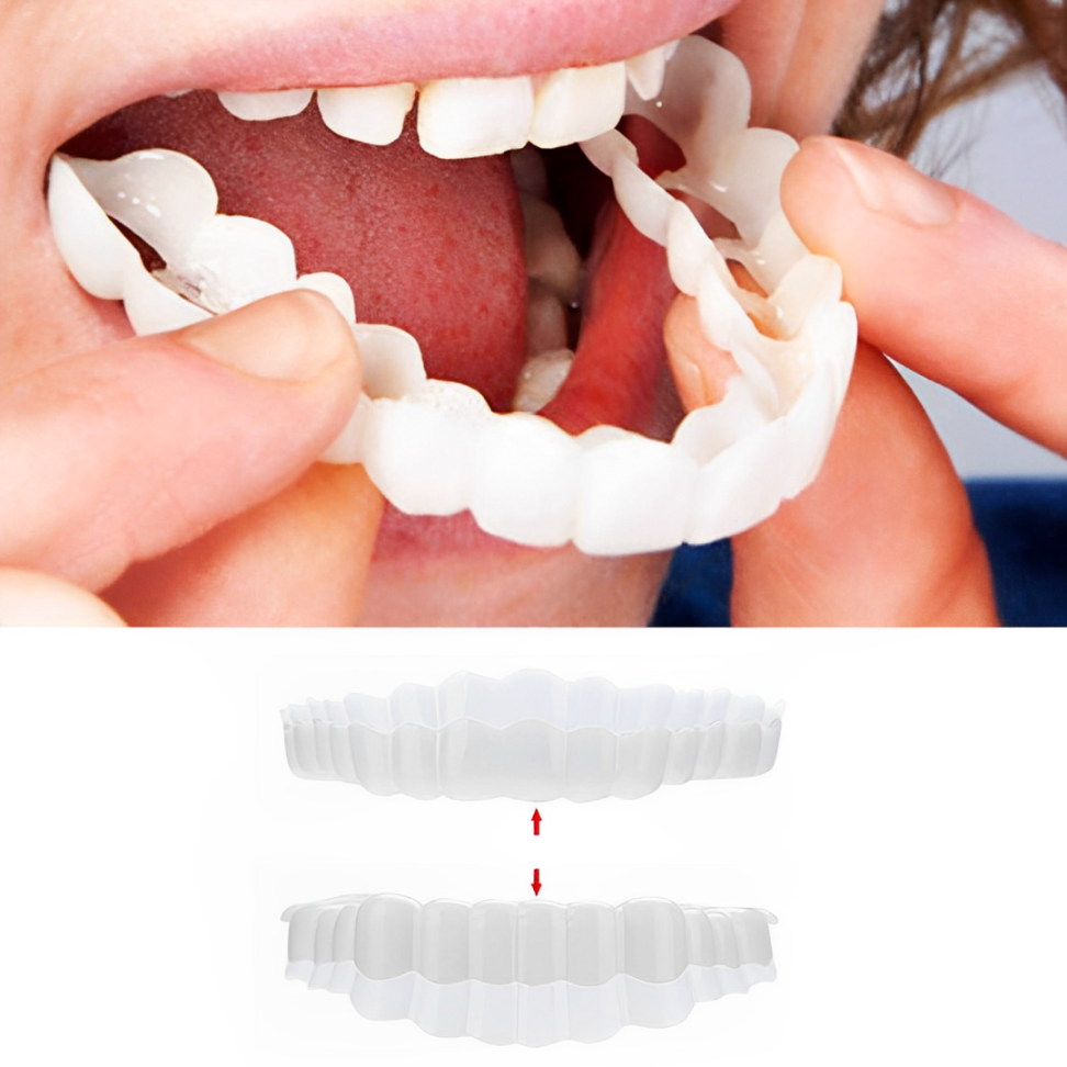 Instant Smile Perfect Veneers Kit