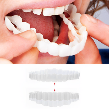 Instant Smile Perfect Veneers Kit