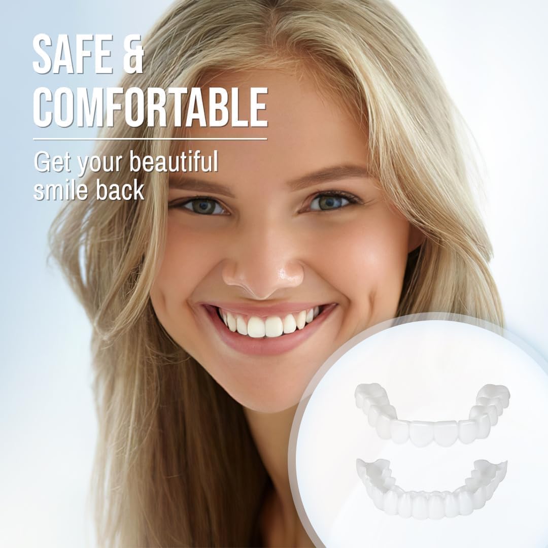 Instant Smile Perfect Veneers Kit