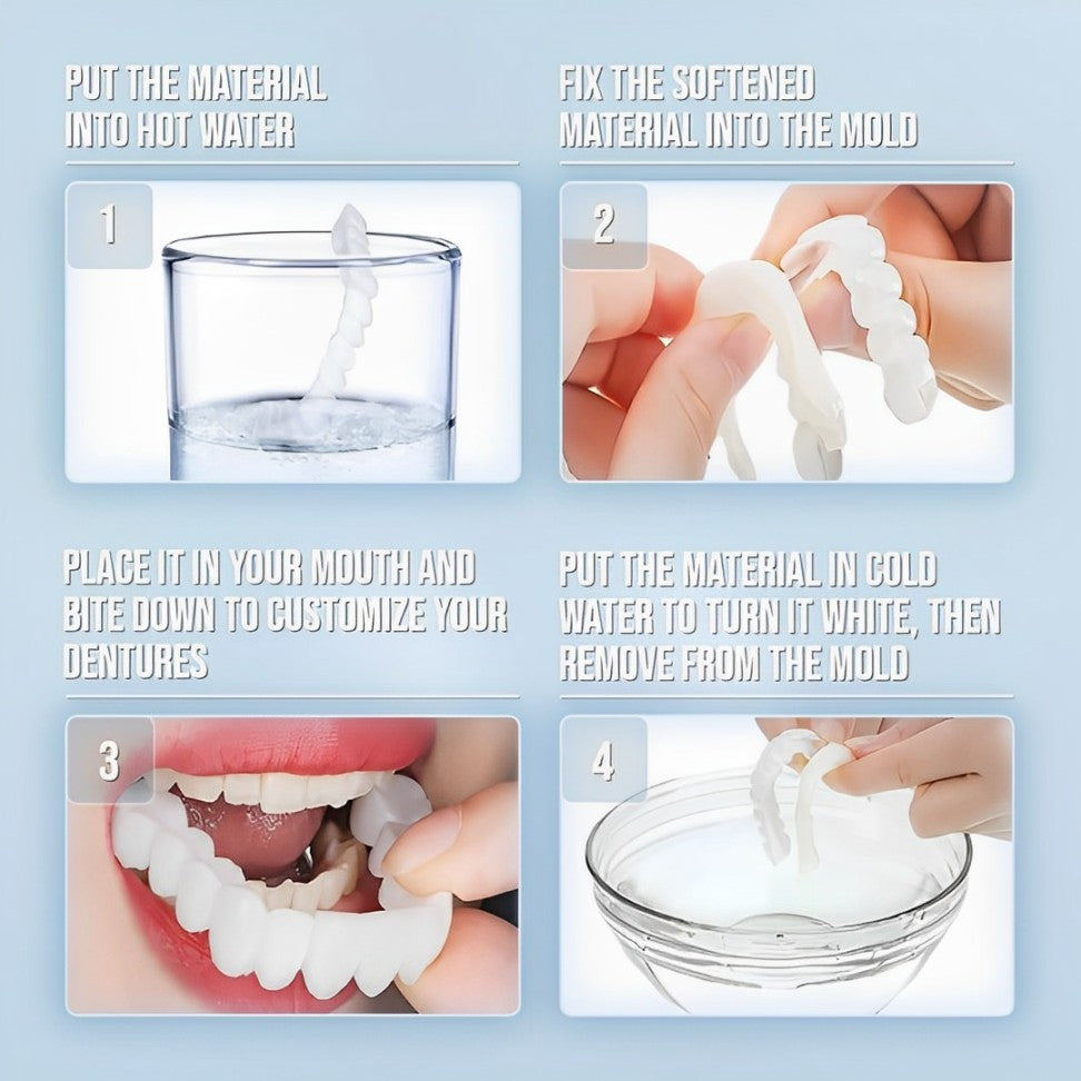 Instant Smile Perfect Veneers Kit